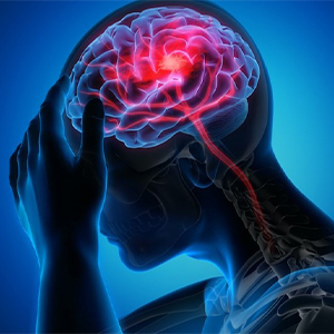 علائم سکته مغزی چیست؟ | زمان طلایی درمان سکته مغزی